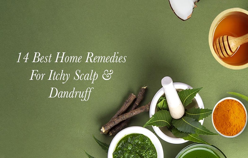 Home Remedies for Itchy Scalp