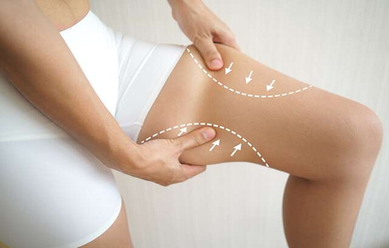 Home Remedies To Get Rid Of Black Patches Between Thighs