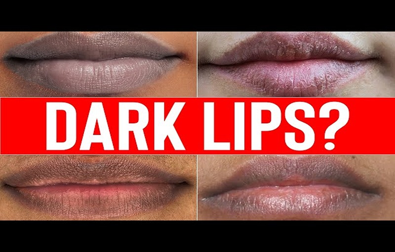 Home Remedies To Treat Dark Lips Permanently