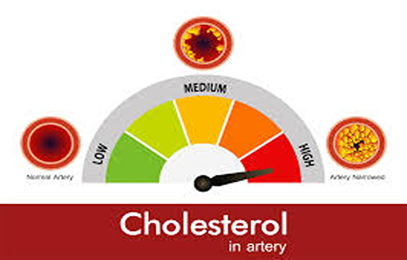 10 High-Cholesterol Foods To Avoid