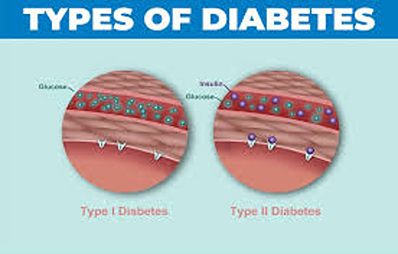 What Is Diabetes And The Different Types?