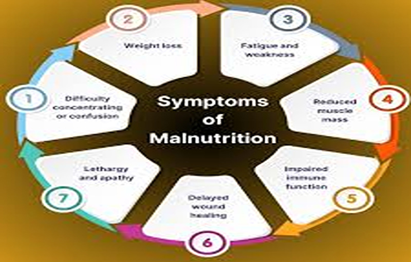 Everything You Need To Know About Malnutrition