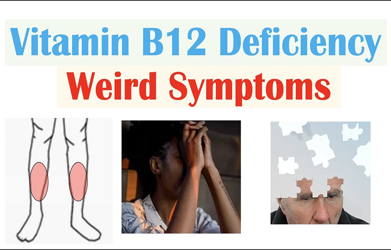 What Are The Symptoms Of B12 Deficiency?