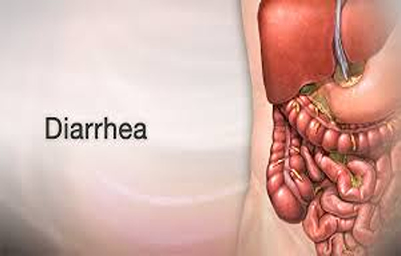 How A Major Disease Like Acute Bloody Diarrhea Can Be Prevented?