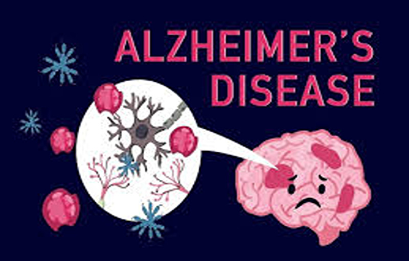 Watch Out For Ten Warning Signs Of Alzheimer’s