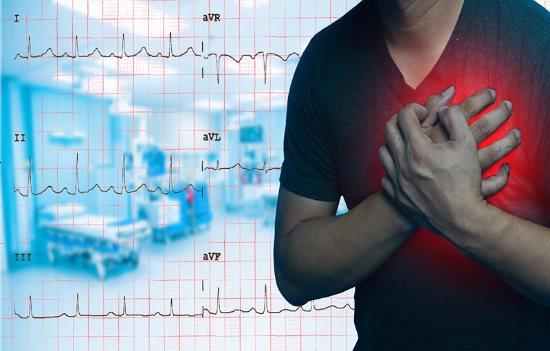 Testosterone Replacement Therapy Linked to Decrease in Cardiovascular Outcomes