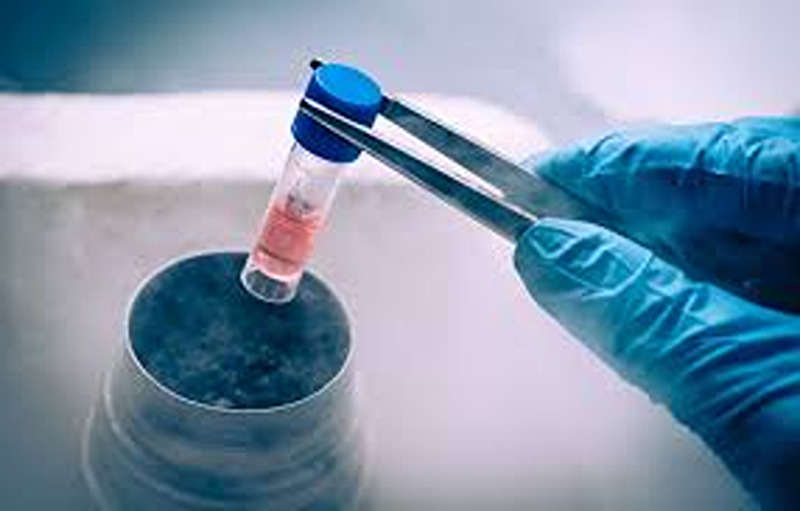 Slow Freeze vs Microfreeze