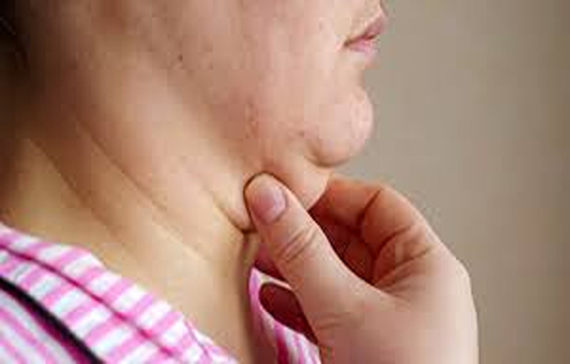 Home Remedies To Treat Double Chin