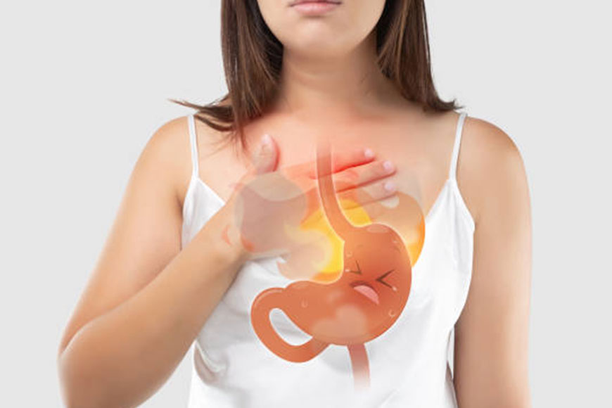 Heartburn Help: Your Guide to GERD Relief