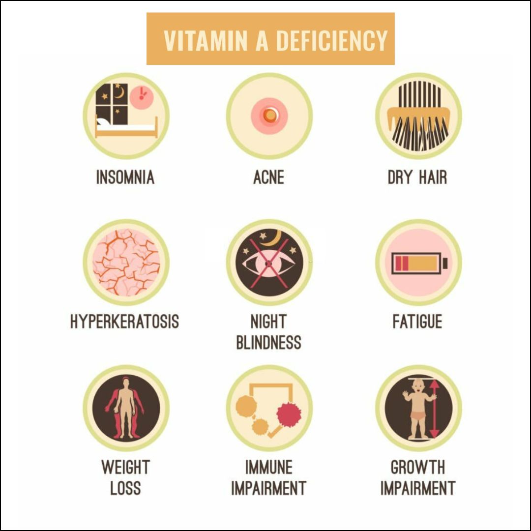 FAQs on Vitamin A Deficiency